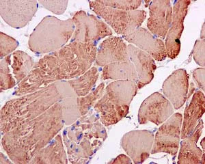 Immunohistochemistry (Formalin/PFA-fixed paraffin-embedded sections) - Anti-B3GALT4 antibody [EPR11650] (AB169759)