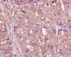 Immunohistochemistry (Formalin/PFA-fixed paraffin-embedded sections) - Anti-B3GALT4 antibody [EPR11650] (AB169759)