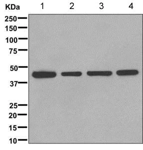 Western blot - Anti-B3GALT4 antibody [EPR11650] (AB169759)