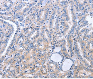 Immunohistochemistry (Formalin/PFA-fixed paraffin-embedded sections) - Anti-B3GAT1 antibody (AB199156)