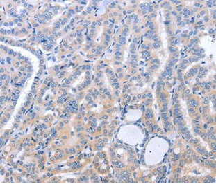 Immunohistochemistry (Formalin/PFA-fixed paraffin-embedded sections) - Anti-B3GAT1 antibody (AB199156)