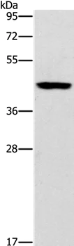 Western blot - Anti-B3GAT1 antibody (AB199156)