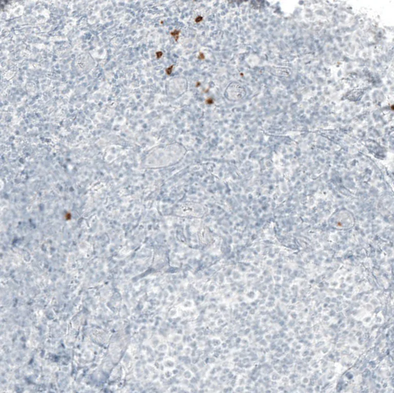 Immunohistochemistry (Formalin/PFA-fixed paraffin-embedded sections) - Anti-B3GAT1 Antibody [CL9500] (AB327128)