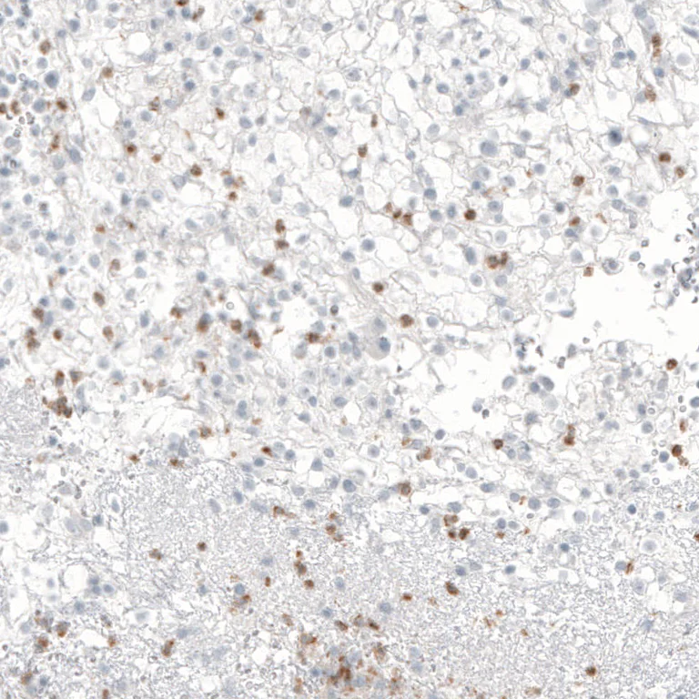 Immunohistochemistry (Formalin/PFA-fixed paraffin-embedded sections) - Anti-B3GAT1 Antibody [CL9500] (AB327128)