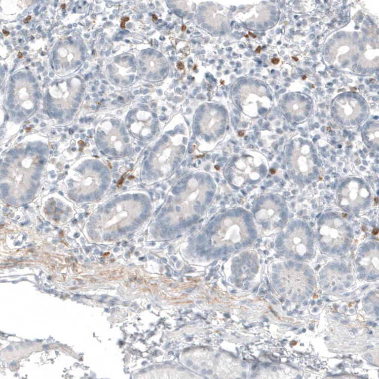 Immunohistochemistry (Formalin/PFA-fixed paraffin-embedded sections) - Anti-B3GAT1 Antibody [CL9500] (AB327128)
