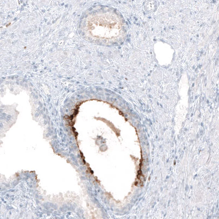 Immunohistochemistry (Formalin/PFA-fixed paraffin-embedded sections) - Anti-B3GAT1 Antibody [CL9500] (AB327128)