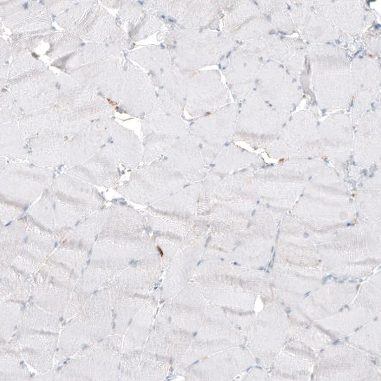 Immunohistochemistry (Formalin/PFA-fixed paraffin-embedded sections) - Anti-B3GAT1 Antibody [CL9500] (AB327128)