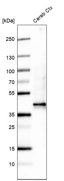 Western blot - Anti-B3GAT1 Antibody [CL9500] (AB327128)