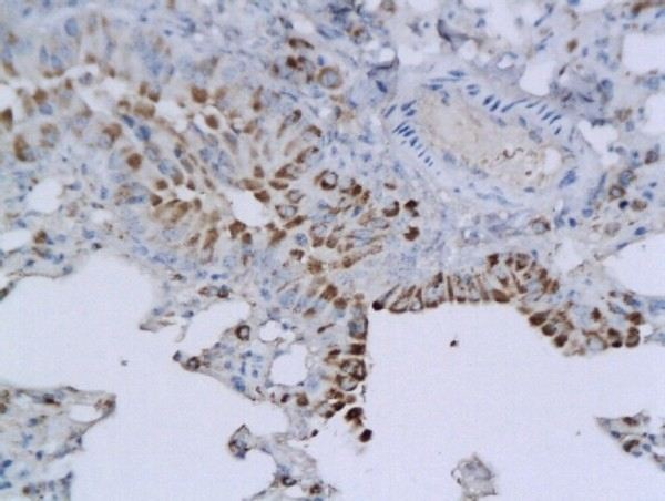 Immunohistochemistry (Formalin/PFA-fixed paraffin-embedded sections) - Anti-B3GAT1 antibody - N-terminal (AB203123)