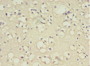 Immunohistochemistry (Formalin/PFA-fixed paraffin-embedded sections) - Anti-B3GNT antibody (AB238818), expandable thumbnail