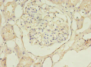Immunohistochemistry (Formalin/PFA-fixed paraffin-embedded sections) - Anti-B3GNT antibody (AB238818)