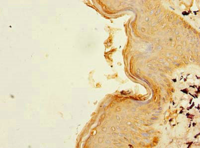 Immunohistochemistry (Formalin/PFA-fixed paraffin-embedded sections) - Anti-B3GNT1 antibody (AB236291)