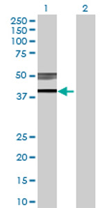 Western blot - Anti-B3GNT3 antibody (AB70156)