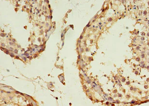 Immunohistochemistry (Formalin/PFA-fixed paraffin-embedded sections) - Anti-B3GNT5 antibody (AB238819)