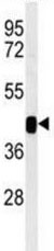 Western blot - Anti-B3GNT7 antibody (AB190217), expandable thumbnail
