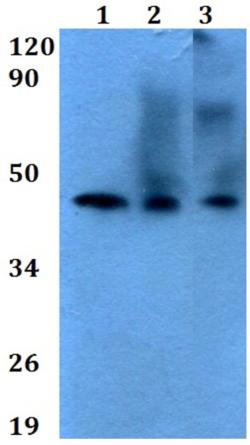 Western blot - Anti-b4Gal-T6 antibody (AB200639), expandable thumbnail