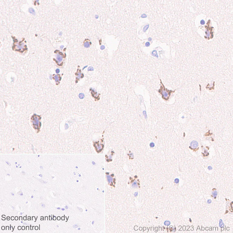 Immunohistochemistry (Formalin/PFA-fixed paraffin-embedded sections) - Anti-B4GALNT1 antibody [EPR28064-64] (AB314130)