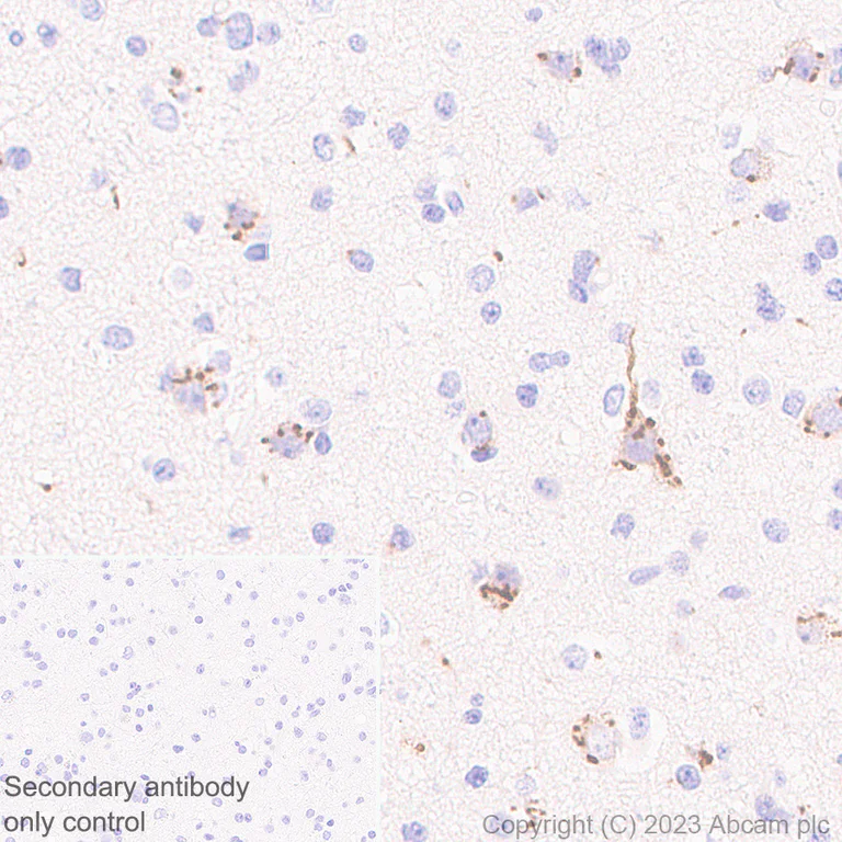 Immunohistochemistry (Formalin/PFA-fixed paraffin-embedded sections) - Anti-B4GALNT1 antibody [EPR28064-64] (AB314130)