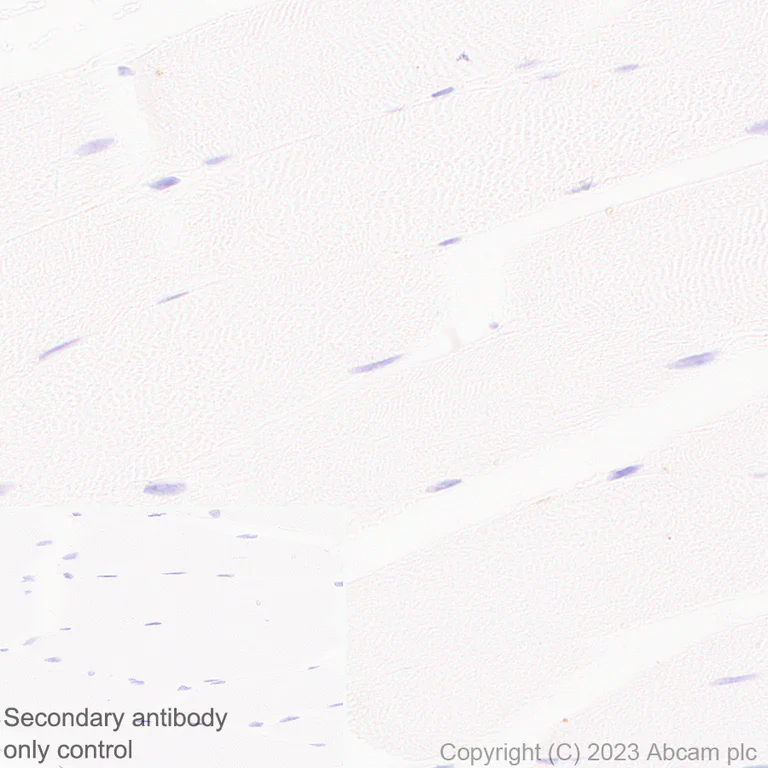 Immunohistochemistry (Formalin/PFA-fixed paraffin-embedded sections) - Anti-B4GALNT1 antibody [EPR28064-64] (AB314130)