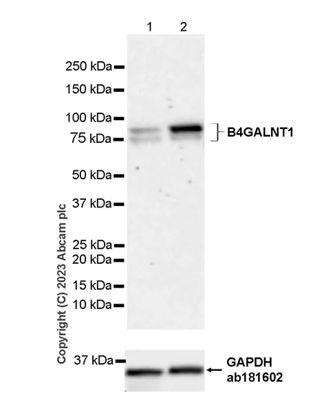 Western blot - Anti-B4GALNT1 antibody [EPR28064-64] (AB314130)