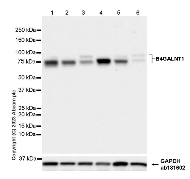 Western blot - Anti-B4GALNT1 antibody [EPR28064-64] - BSA and Azide free (AB314131)