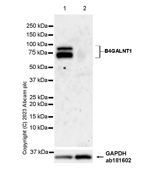 Western blot - Anti-B4GALNT1 antibody [EPR28064-64] - BSA and Azide free (AB314131)
