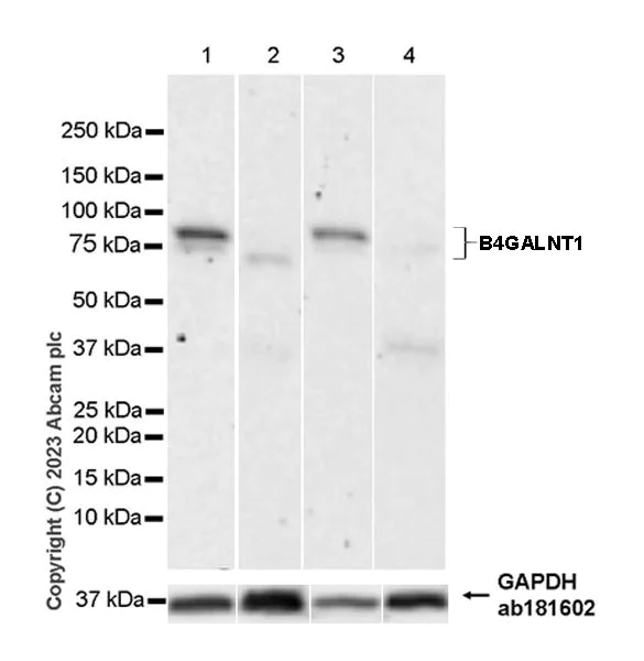 Western blot - Anti-B4GALNT1 antibody [EPR28064-64] - BSA and Azide free (AB314131)