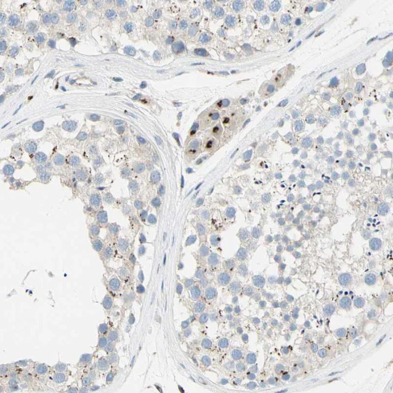 Immunohistochemistry (Formalin/PFA-fixed paraffin-embedded sections) - Anti-B4GALT1 antibody (AB121326)