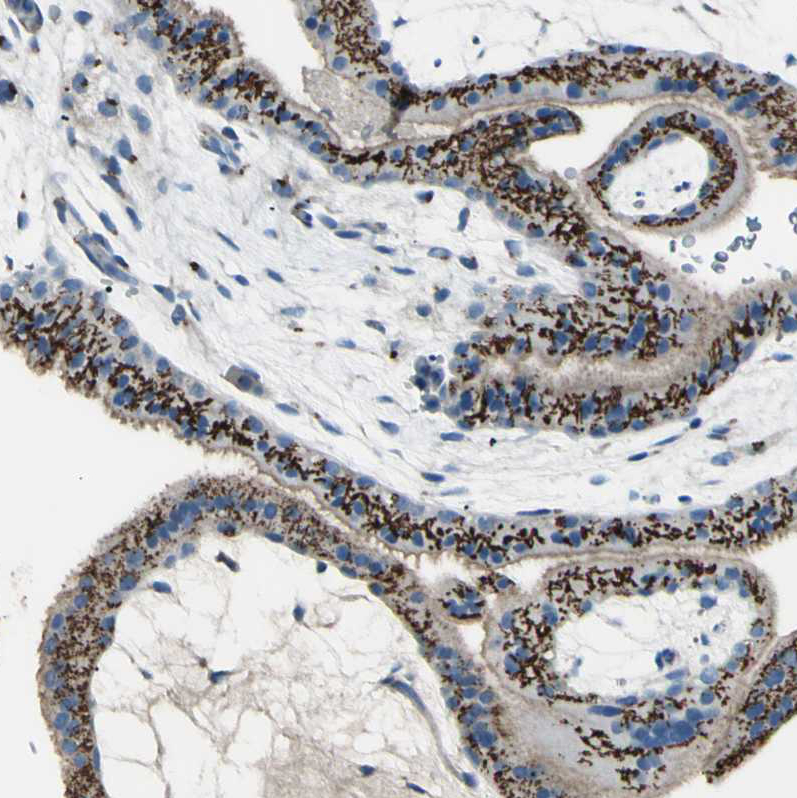 Immunohistochemistry (Formalin/PFA-fixed paraffin-embedded sections) - Anti-B4GALT1 antibody (AB121326)