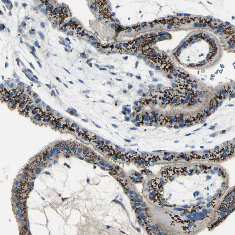 Immunohistochemistry (Formalin/PFA-fixed paraffin-embedded sections) - Anti-B4GALT1 antibody (AB121326)
