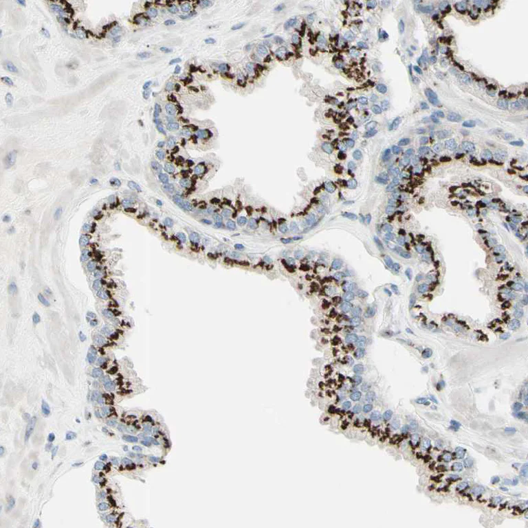 Immunohistochemistry (Formalin/PFA-fixed paraffin-embedded sections) - Anti-B4GALT1 antibody (AB121326)