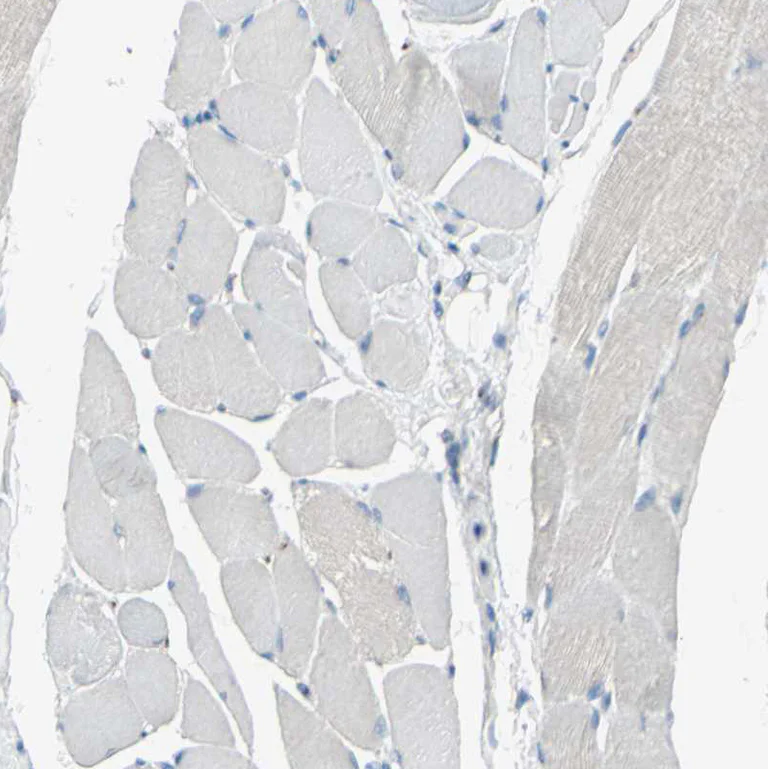 Immunohistochemistry (Formalin/PFA-fixed paraffin-embedded sections) - Anti-B4GALT1 antibody (AB121326)