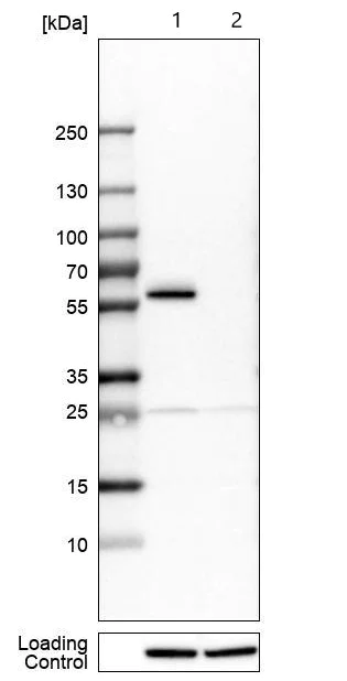 Western blot - Anti-B4GALT1 antibody (AB121326)