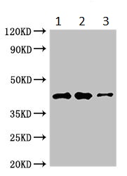 Western blot - Anti-B4GALT2 antibody (AB234707)