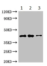 Western blot - Anti-B4GALT2 antibody (AB234707)
