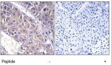 Immunohistochemistry (Formalin/PFA-fixed paraffin-embedded sections) - Anti-B4GALT3 antibody (AB74825)