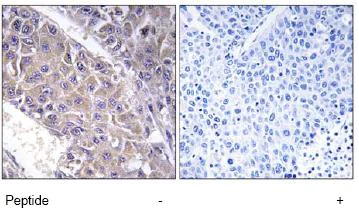 Immunohistochemistry (Formalin/PFA-fixed paraffin-embedded sections) - Anti-B4GALT3 antibody (AB74825)