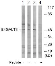 Western blot - Anti-B4GALT3 antibody (AB74825)
