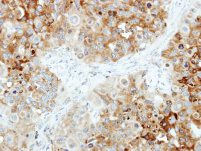 Immunohistochemistry (Formalin/PFA-fixed paraffin-embedded sections) - Anti-B4GALT4 antibody (AB155476)