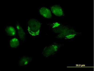 Immunocytochemistry/ Immunofluorescence - Anti-B4GALT4 antibody (AB169604)