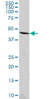 Western blot - Anti-B4GALT4 antibody (AB169604)