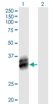 Western blot - Anti-B4GALT4 antibody (AB169604)