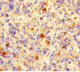 Immunohistochemistry (Formalin/PFA-fixed paraffin-embedded sections) - Anti-B7-H6 antibody (AB229999)