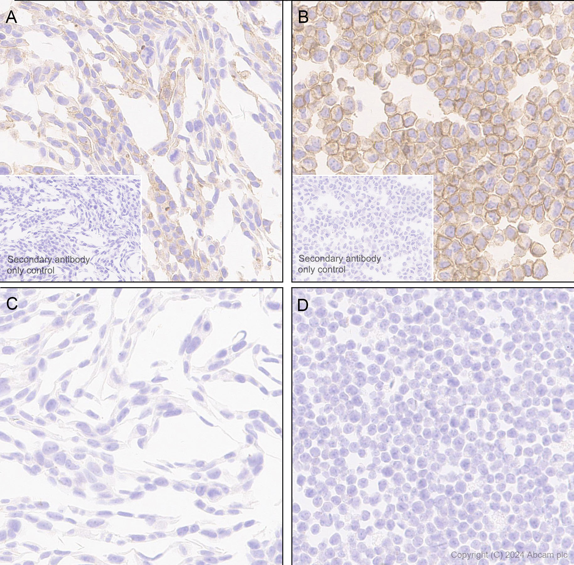 Immunohistochemistry (Formalin/PFA-fixed paraffin-embedded sections) - Anti-B7-H6 antibody [EPR28658-68] - BSA and Azide free (AB316976), expandable thumbnail