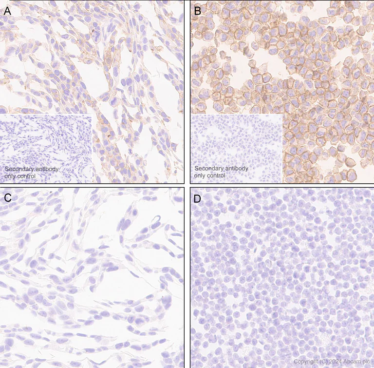 Immunohistochemistry (Formalin/PFA-fixed paraffin-embedded sections) - Anti-B7-H6 antibody [EPR28658-68] - BSA and Azide free (AB316976)
