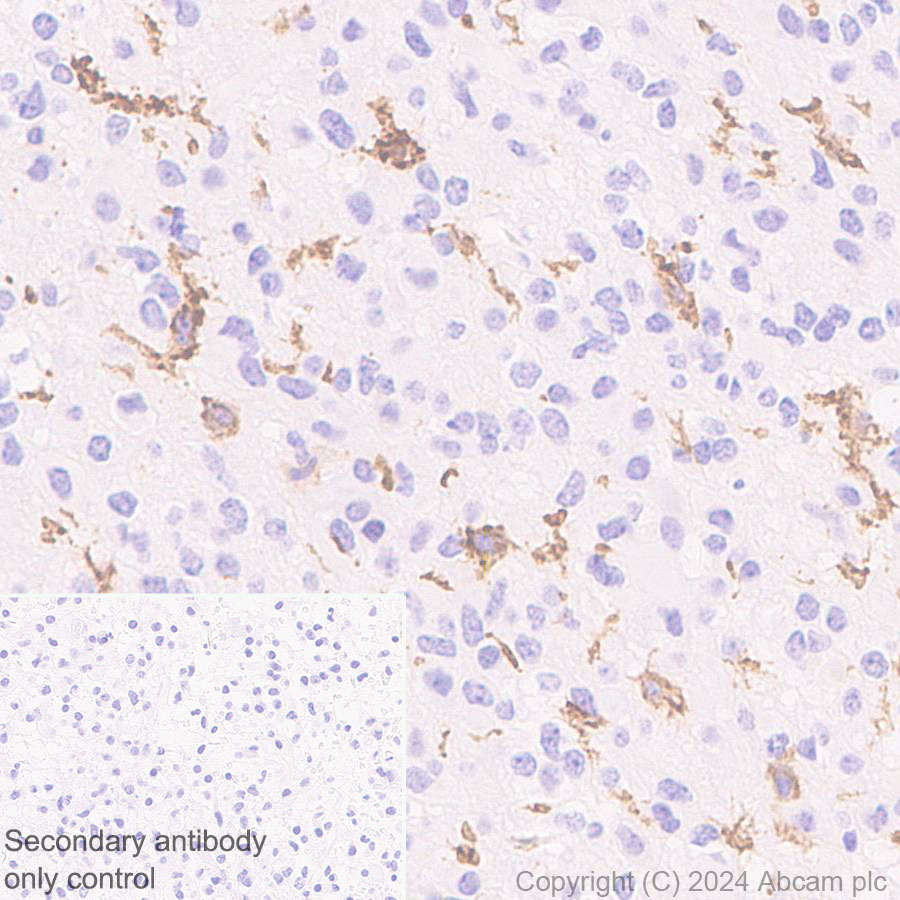 Immunohistochemistry (Formalin/PFA-fixed paraffin-embedded sections) - Anti-B7-H6 antibody [EPR28658-68] - BSA and Azide free (ab316976), expandable thumbnail