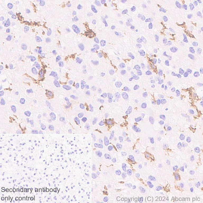 Immunohistochemistry (Formalin/PFA-fixed paraffin-embedded sections) - Anti-B7-H6 antibody [EPR28658-68] - BSA and Azide free (AB316976)