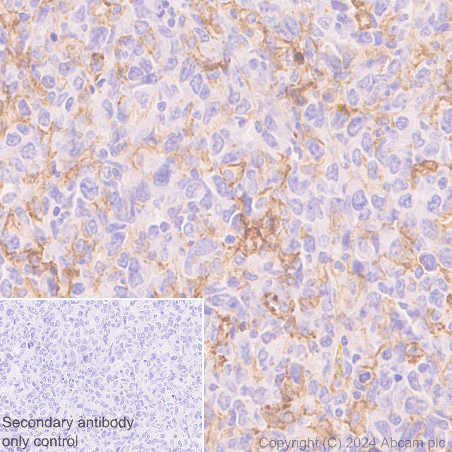 Immunohistochemistry (Formalin/PFA-fixed paraffin-embedded sections) - Anti-B7-H6 antibody [EPR28658-68] - BSA and Azide free (AB316976), expandable thumbnail