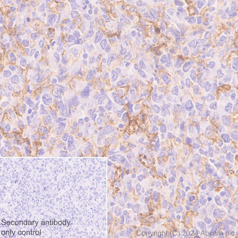 Immunohistochemistry (Formalin/PFA-fixed paraffin-embedded sections) - Anti-B7-H6 antibody [EPR28658-68] - BSA and Azide free (AB316976)
