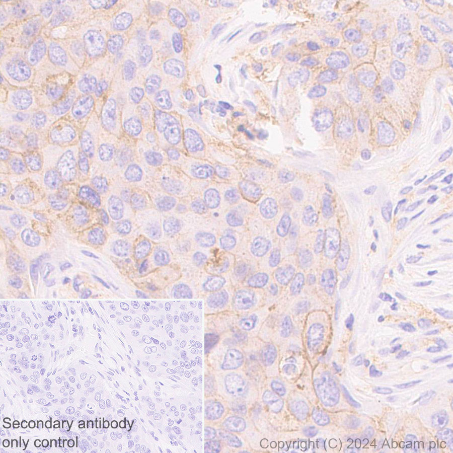 Immunohistochemistry (Formalin/PFA-fixed paraffin-embedded sections) - Anti-B7-H6 antibody [EPR28658-68] - BSA and Azide free (AB316976), expandable thumbnail
